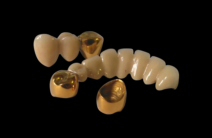 Base Metal Crown